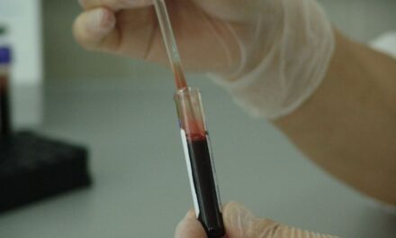 virus